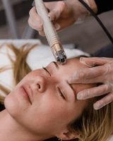 Professional acne treatment room at Vitality Laser Skin Geelong