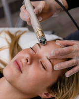 Professional acne treatment room at Vitality Laser Skin Geelong