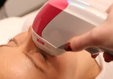 Ultraformer MPT skin tightening treatment for jawline and face