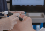 Dermal Clinician creating a personalised spring skin treatment plan at Vitality in Geelong