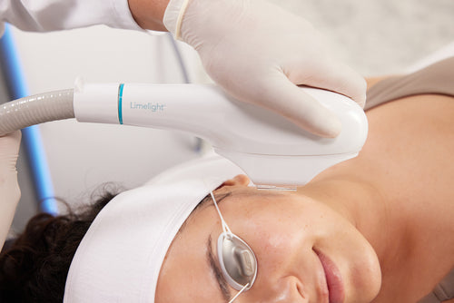 Limelight IPL