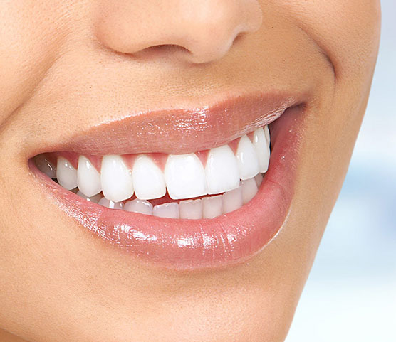 vitality laser skin teeth whitening